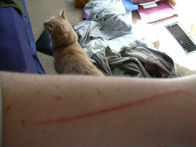 My cleaned up arm after we got home from the vet.  When we were leaving, it was dripping blood.